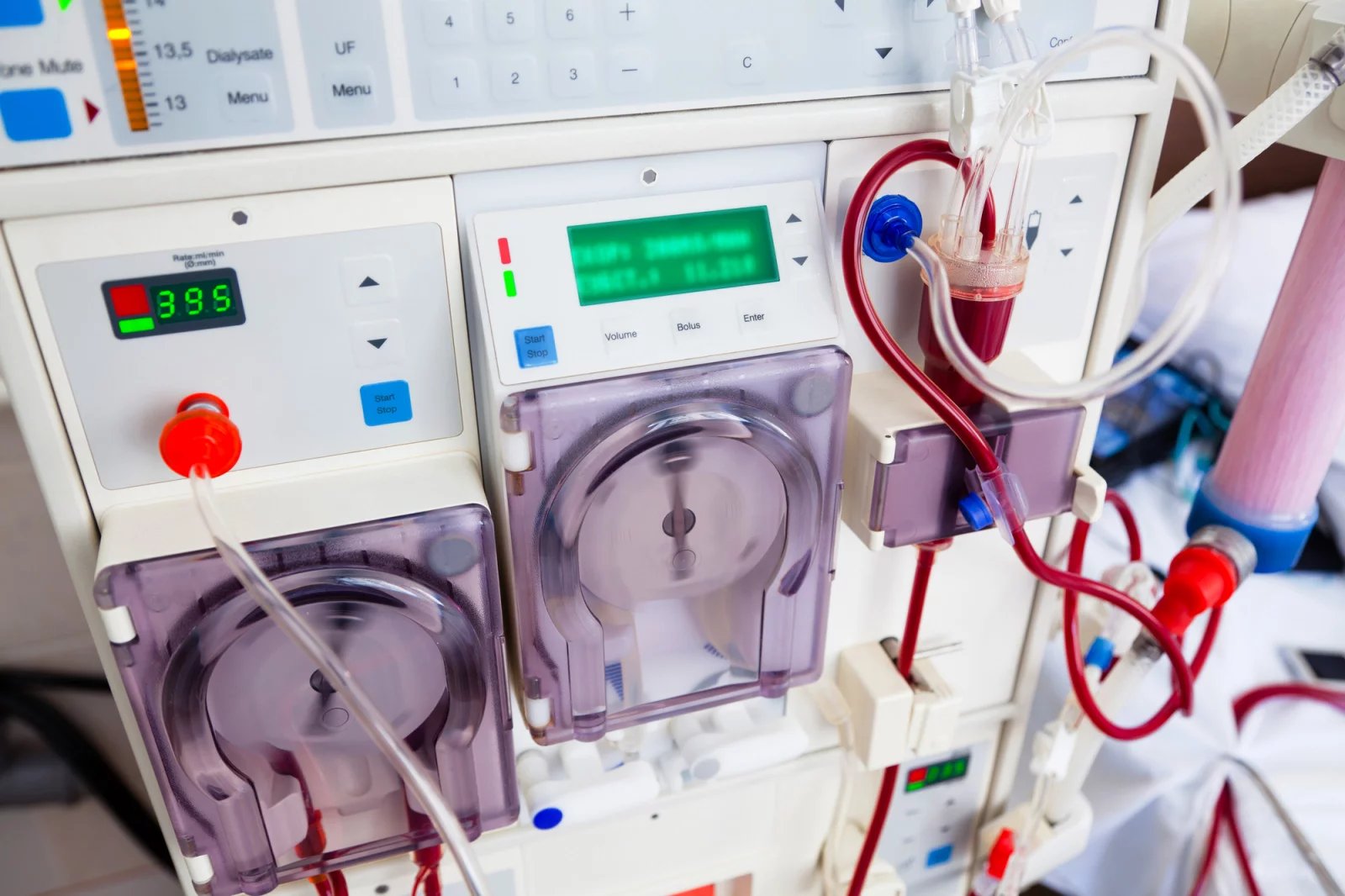 U peritoneální dialýzy rozlišujeme dva typy – kontinuální ambulantní a automatizovanou. V případě ambulantní peritoneální dialýzy si pacient provádí výměny několikrát za den ručně. U automatizované peritoneální dialýzy se provádí výměny v průběhu spánku pomocí přístroje.