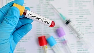 Náhledový obrázek - Vysoký cholesterol může končit mrtvicí i infarktem myokardu. Jak jej efektivně snížit?