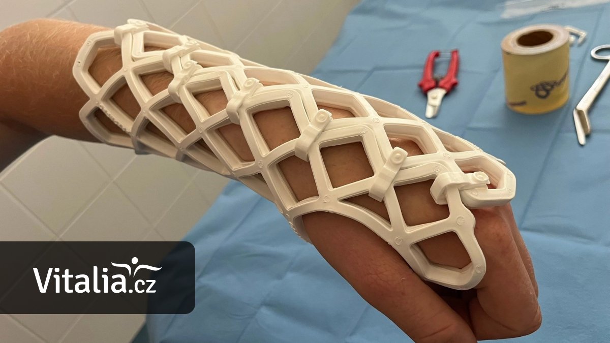 „Letní sádra“ sice může do vody, na plavání a tobogány ale zapomeňte