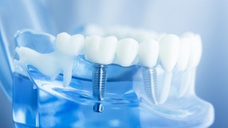 Zuby z vlastních buněk místo titanových šroubů? Regenerativní medicína míří k velkému průlomu ve stomatologii