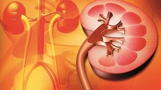 Náhledový obrázek - IKEM: Léčba chronické hepatitidy C a možnost transplantace ledviny