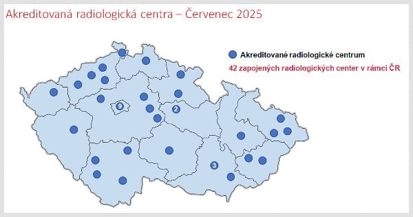 Mapa akreditovaných center screeningu rakoviny plic, která provádí nízkodávková CT vyšetření