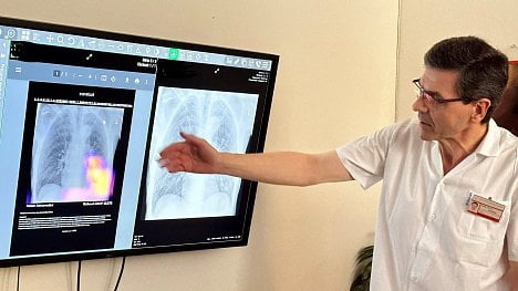 Náhledový obrázek - Robot diagnostik. S rozpoznáváním chorob by českým zdravotníkům mohla pomoci umělá inteligence