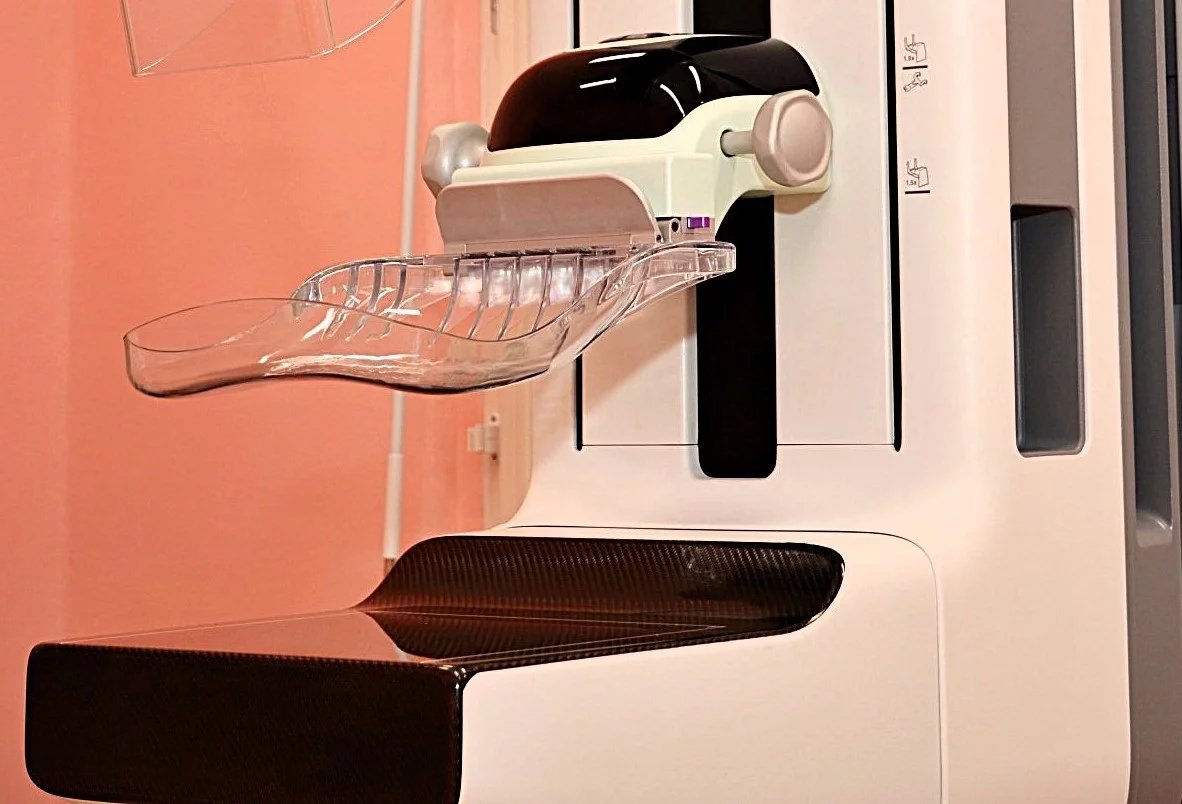 Nový mamograf ve Fakultní Thomayerově nemocnici využívá umělou inteligenci