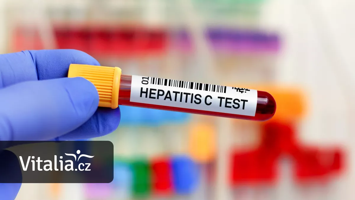 Hepatitidou C se můžete nakazit opakovaně. Kdy má smysl si říct o test?