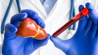 Náhledový obrázek - Čím podpořit normální činnost jater při zvýšených hodnotách jaterních testů?