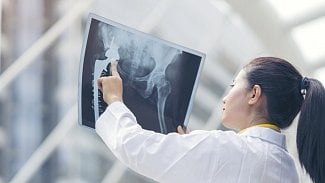 Náhledový obrázek - Kvíz: Znáte základy anatomie?