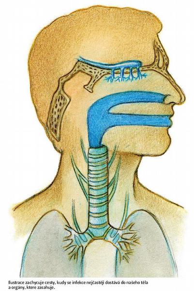 Ilustrace zachycuje cesty, kudy se infekce nejčastěji dostává do našeho těla a orgány, ktere zasahuje.