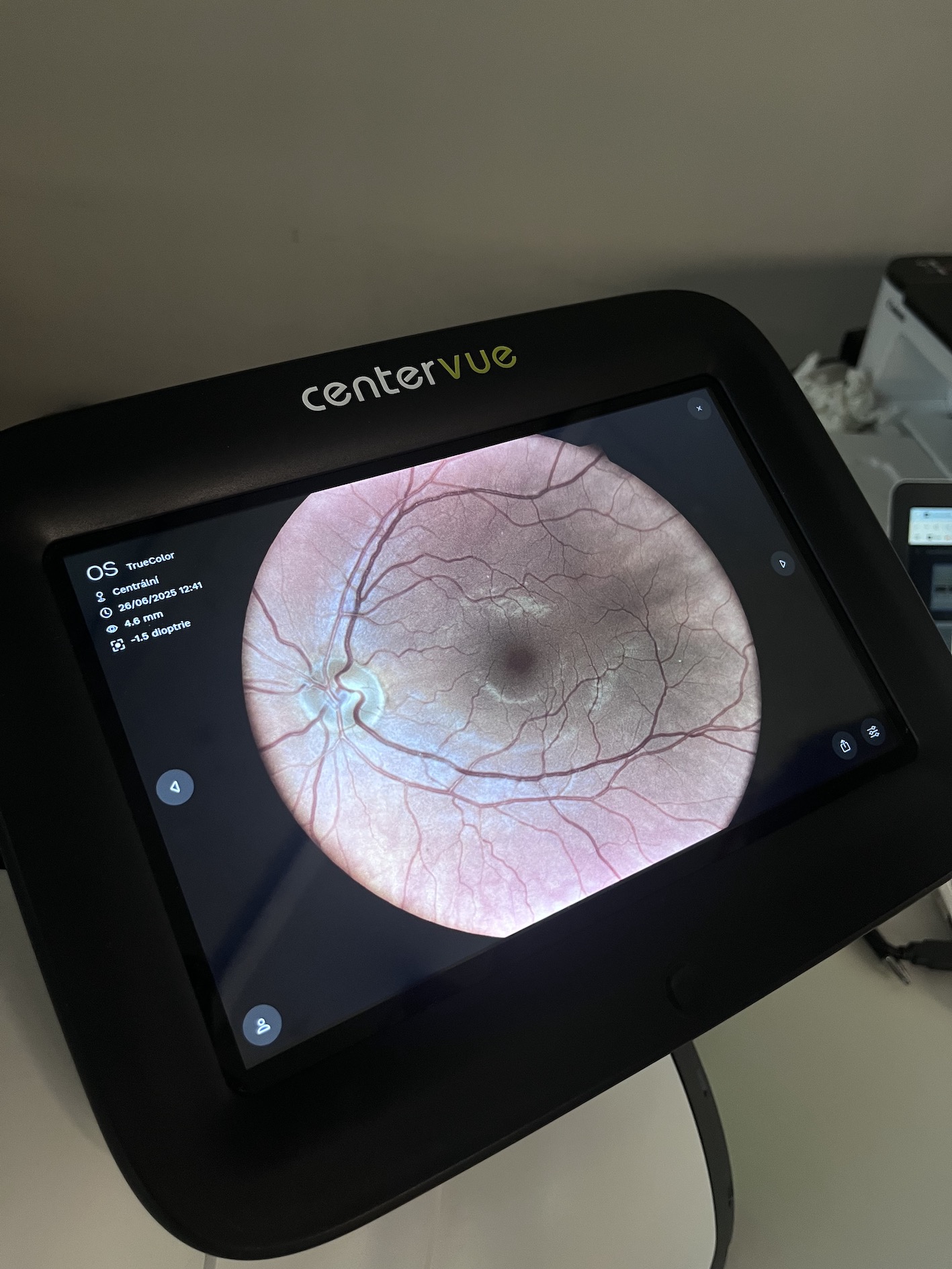 Vyšetření očního pozadí pomocí přístroje, který k vyhodnocení používá umělou inteligenci