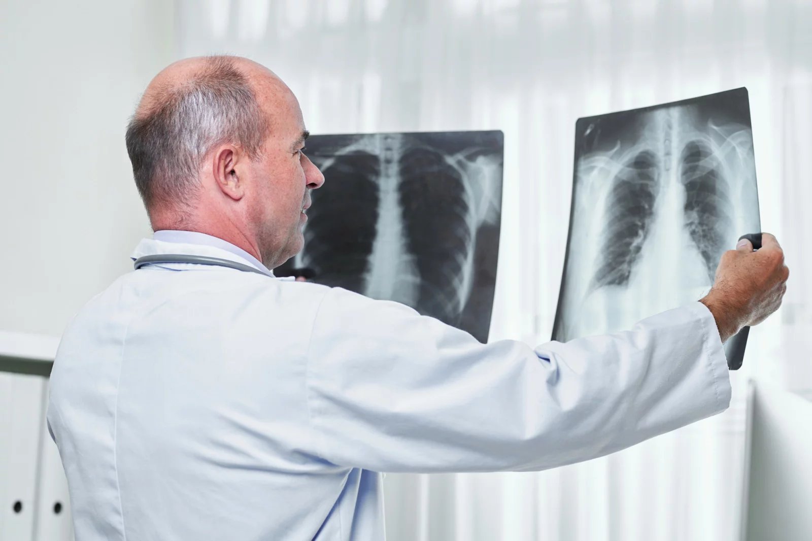 Při určení CHOPN se vedle zjišťování celkové anamnézy pacienta provádí také tělesná prohlídka a měření saturace hemoglobinu kyslíkem. Poté se u pacienta provádí rentgen hrudníku, spirometrické vyšetření či krevní rozbor.