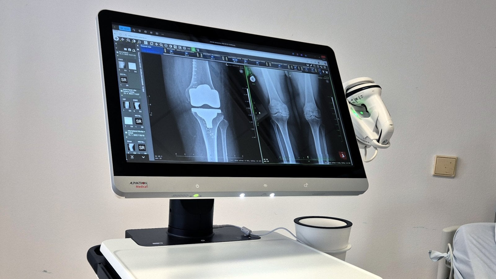 Telemedicína přes 5G ve Vojenské nemocnici Brno