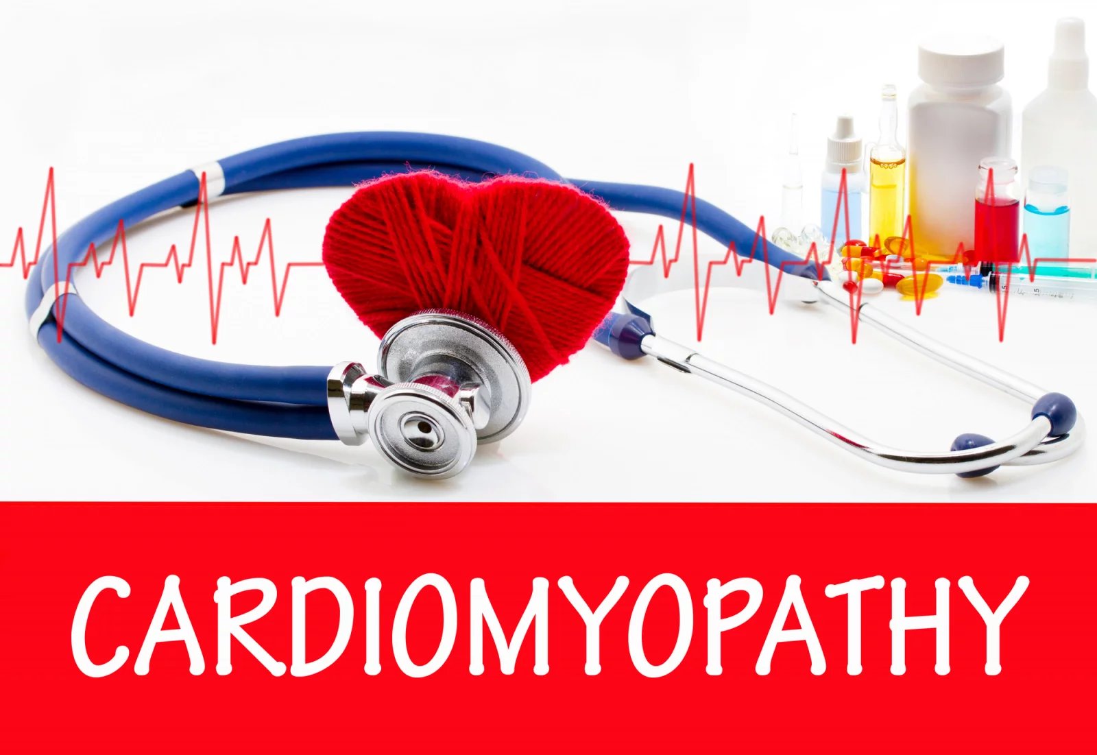 Kardiomyopatie se dá odhalit například na základě EKG provedeného v rámci preventivní prohlídky u praktika. Pokud pacienti začnou mít potíže, bývá na léčbu někdy už pozdě. „