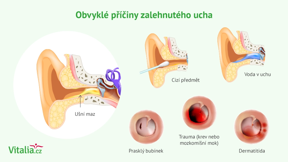 voda z ucha nejde ven