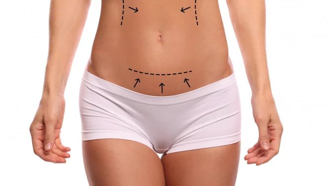 Body contouring není nástrtojem hubnutí. Protože obézním lidem by se tyto zákroky dělat neměly, není to nástroj hubnutí. Něco jiného je, pokud už člověk výrazně snížil váhu a potýká se s povolenou kůží v různých partiích nebo pokud se snaží, cvičí, dodržuje životosprávu, a přesto se nedokáže zbavit všeho přebytečného tuku.