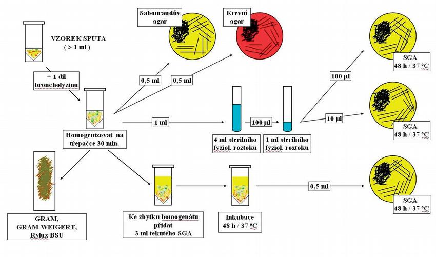 Obr. 6 – Postup zpracování sputa v mykologické laboratoři