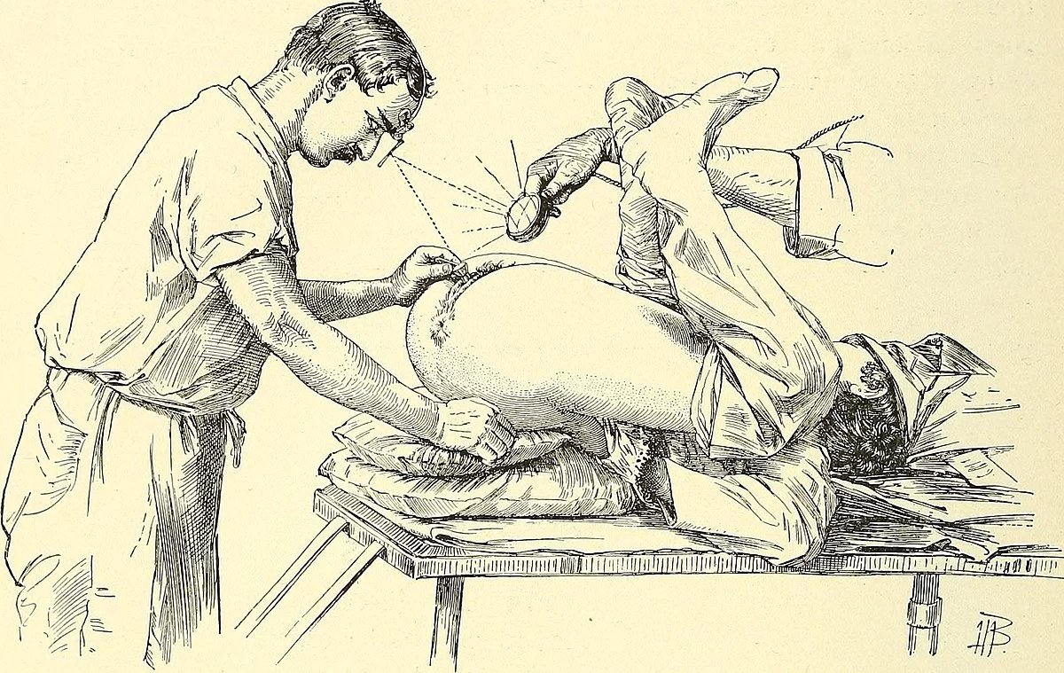 Z učebnice moderní gynekologie, rok 1906