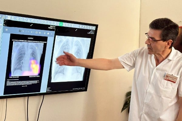 Lékař z Nemocnice Havířov ukazuje snímek vyhodnocený umělou inteligencí.