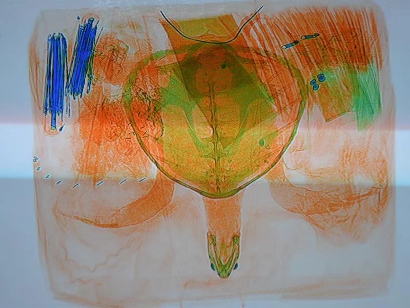 Nedovolené suvenýry z ciziny