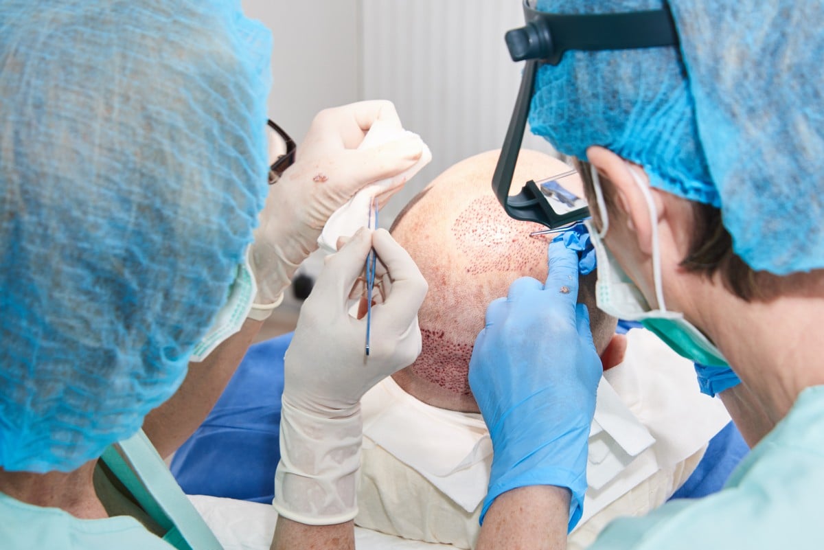 Robotický transplantační systém Artas při práci