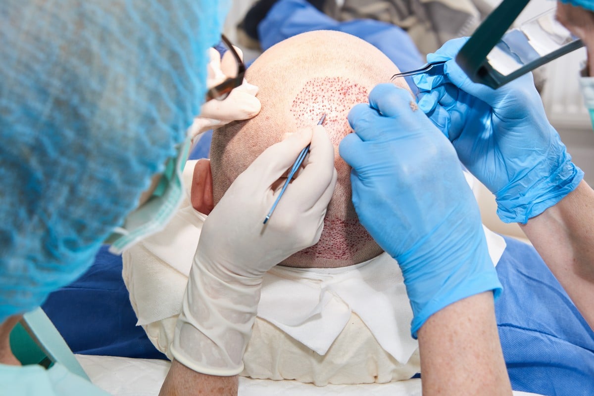 Robotický transplantační systém Artas při práci