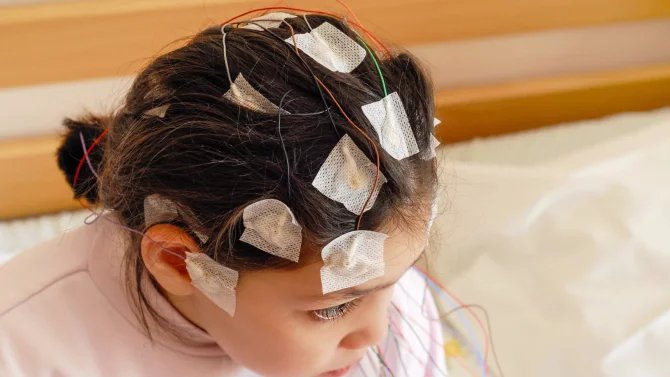 eeg epilepsie dítě