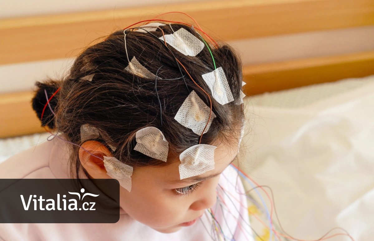 Operace umí zbavit děti epilepsie, mohou pak žít stejně jako jejich vrstevníci