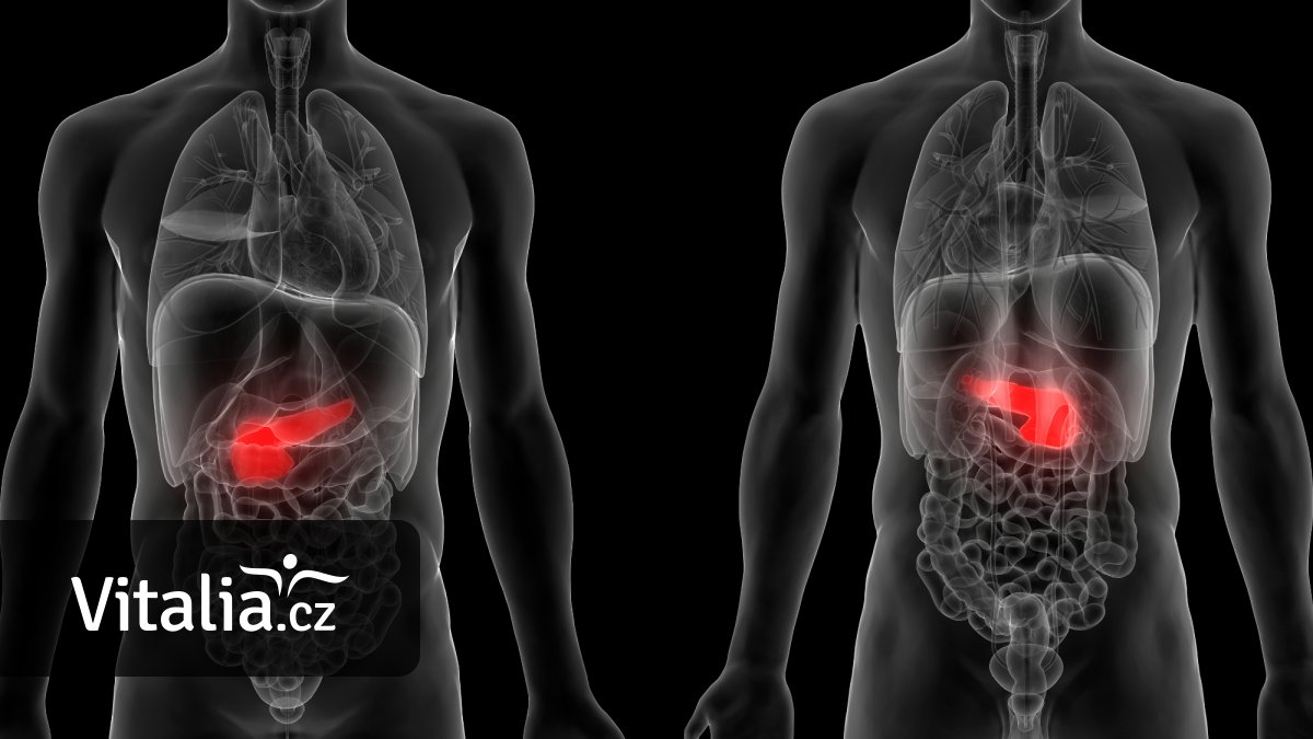 Vyhledávat pacienty s rakovinou slinivky bude 500 praktiků. Diabetiky v riziku čeká CT vyšetření