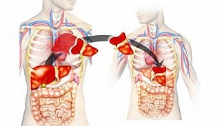 Náhledový obrázek - Lékaři transplantovali loni orgány od 282 lidí, zatím nejvíc