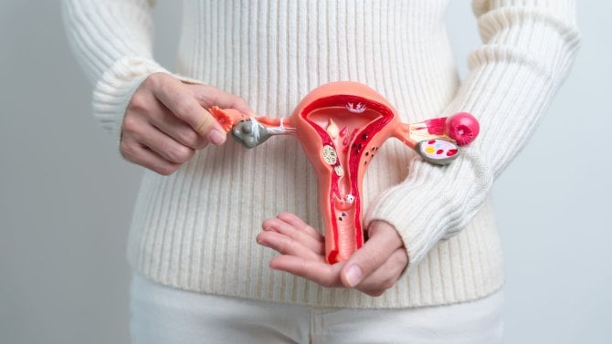 endometrióza