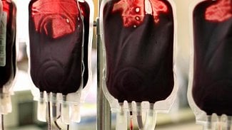 Náhledový obrázek - Praha poskytne MHD zdarma častým dárcům krve