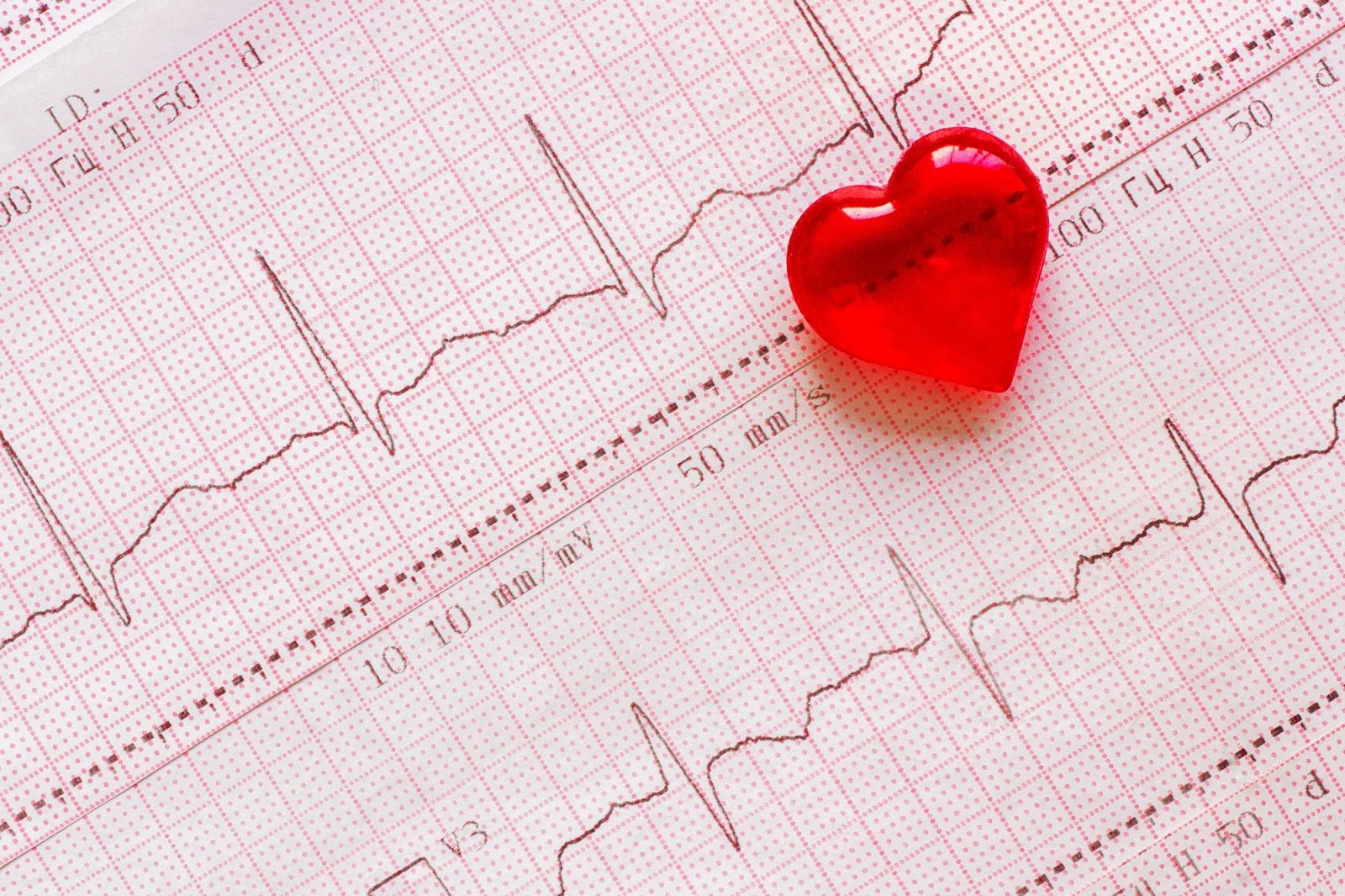 Pokud má lékař podezření na fibrilaci srdečních síní, pravděpodobně doporučí natočit EKG. S určením diagnózy umí pomoci též holter, který má za úkol sledovat a zaznamenávat činnost srdce pacienta po stanovenou dobu.