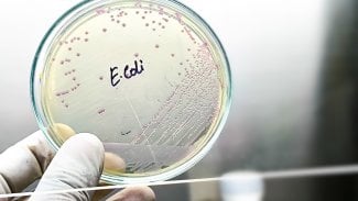 Bakterie E. coli
