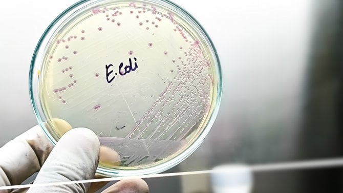 E. coli jako nejlepší experimentální organismus v mikrobiologii. Unikátní bakterie stojí za mnoha převratnými objevy