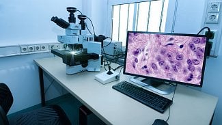 Náhledový obrázek - Histologie zkoumá mikroskopickou strukturu tkání a orgánů. Kdy se provádí histologické vyšetření?