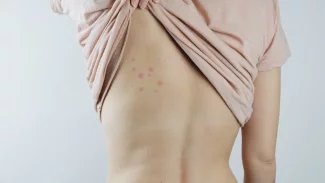 Pokud si přinesete například z dovolené několik jedinců, je možné použít běžné komerčně dostupné biocidní přípravky… Pokud je výskyt většího rozsahu, je potřeba zajistit likvidaci štěnic osobou, která má odbornou způsobilost k provádění speciální ochranné dezinsekce, uvádí na svém webu ostravská hygienická stanice.