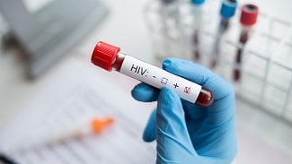 Náhledový obrázek - Onemocnění AIDS předchází nákaza virem HIV. Jaké jsou jeho příznaky?