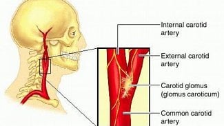 Náhledový obrázek - Homolka zavedla novou metodu léčbu vysokého krevního tlaku