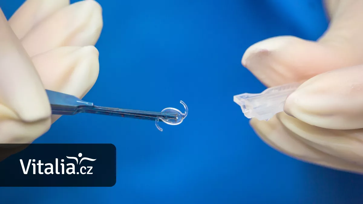 Šedý zákal se může ozvat už před padesátkou. Pomohou nitrooční čočky, základní jsou na pojišťovnu