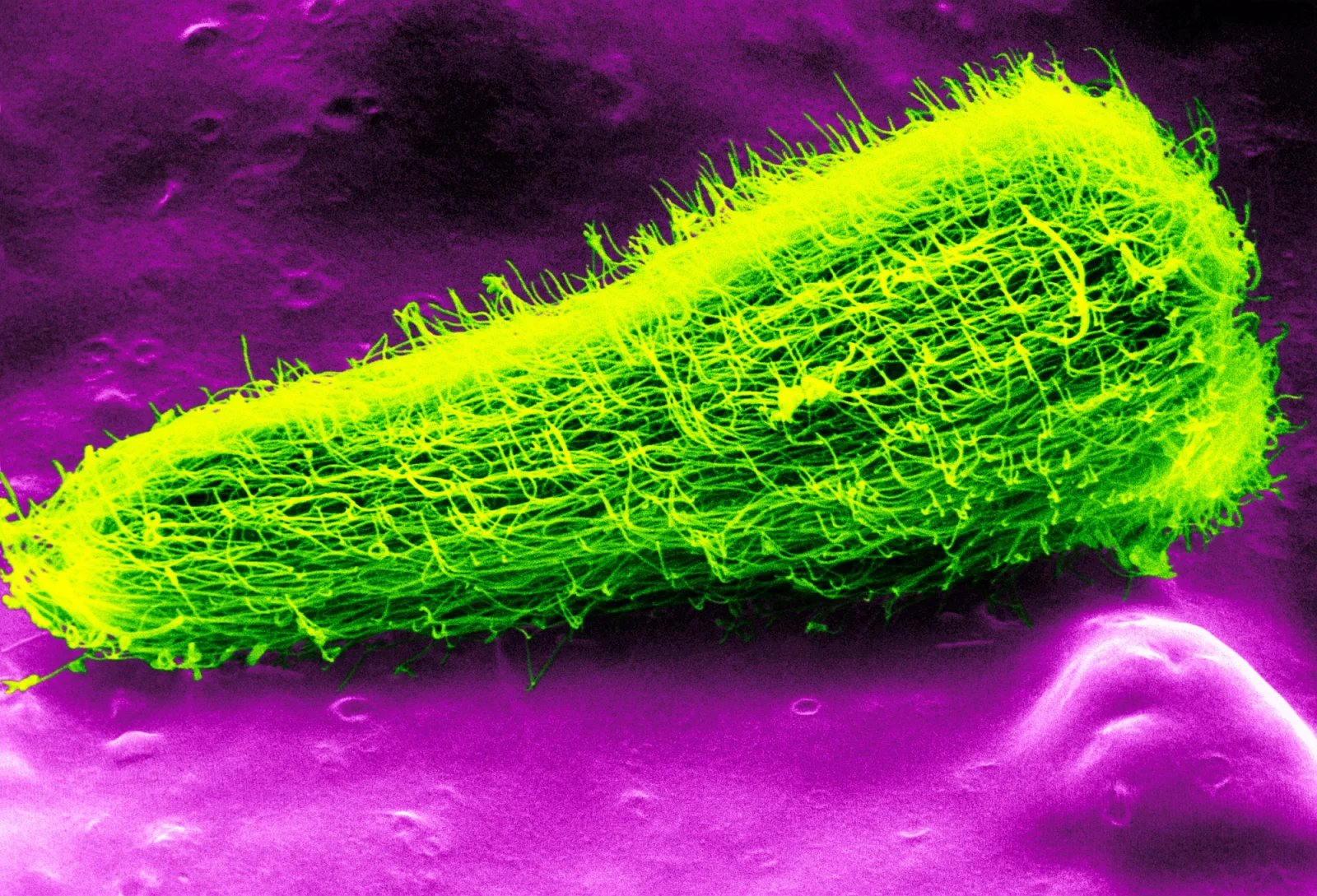 Larva motolice jaterní