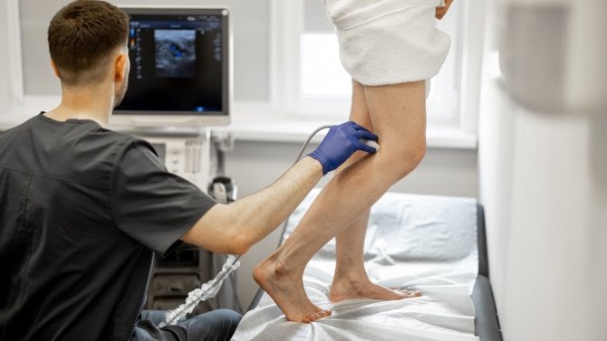 Vyšetření žil pomocí ultrazvuku