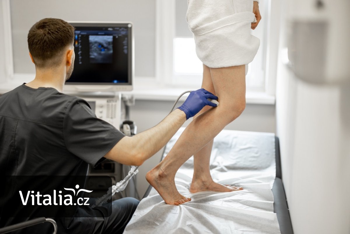 Vyšetření žil nebolí. Hlavně ho neodkládejte, problém sám od sebe nezmizí