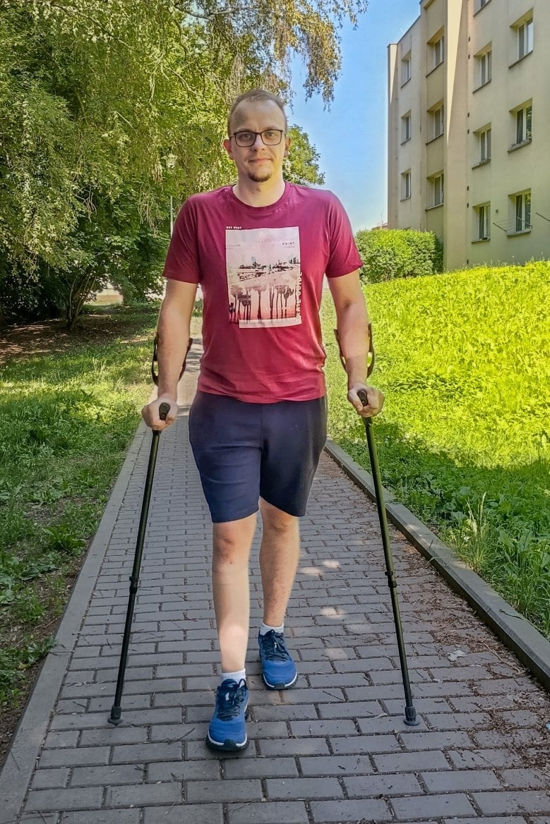 prodlužování končetin ortopedie olomouc