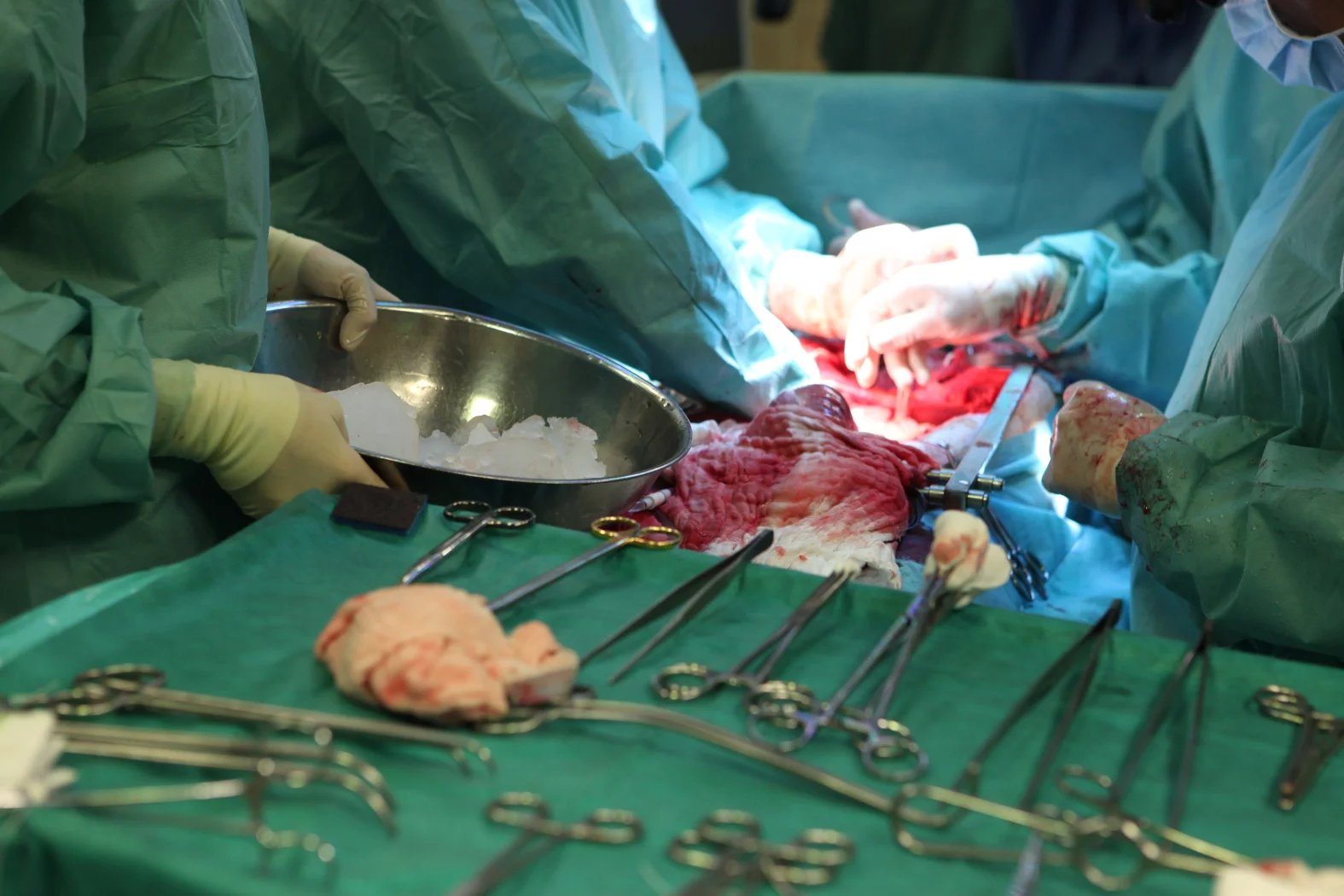 Lékaři mu kromě tenkého střeva transplantovali při jedné operaci i žaludek, slinivku, slezinu a játra.