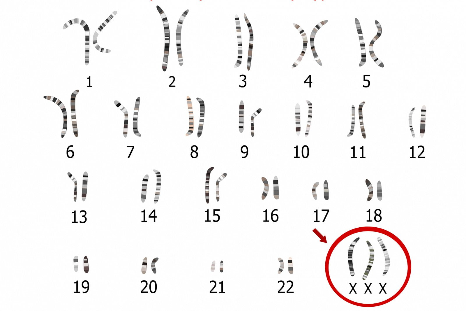 Genetická onemocnění vzniklá chybami v počtu či tvaru chromozomů