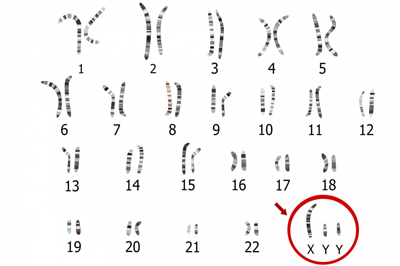 Genetická onemocnění vzniklá chybami v počtu či tvaru chromozomů