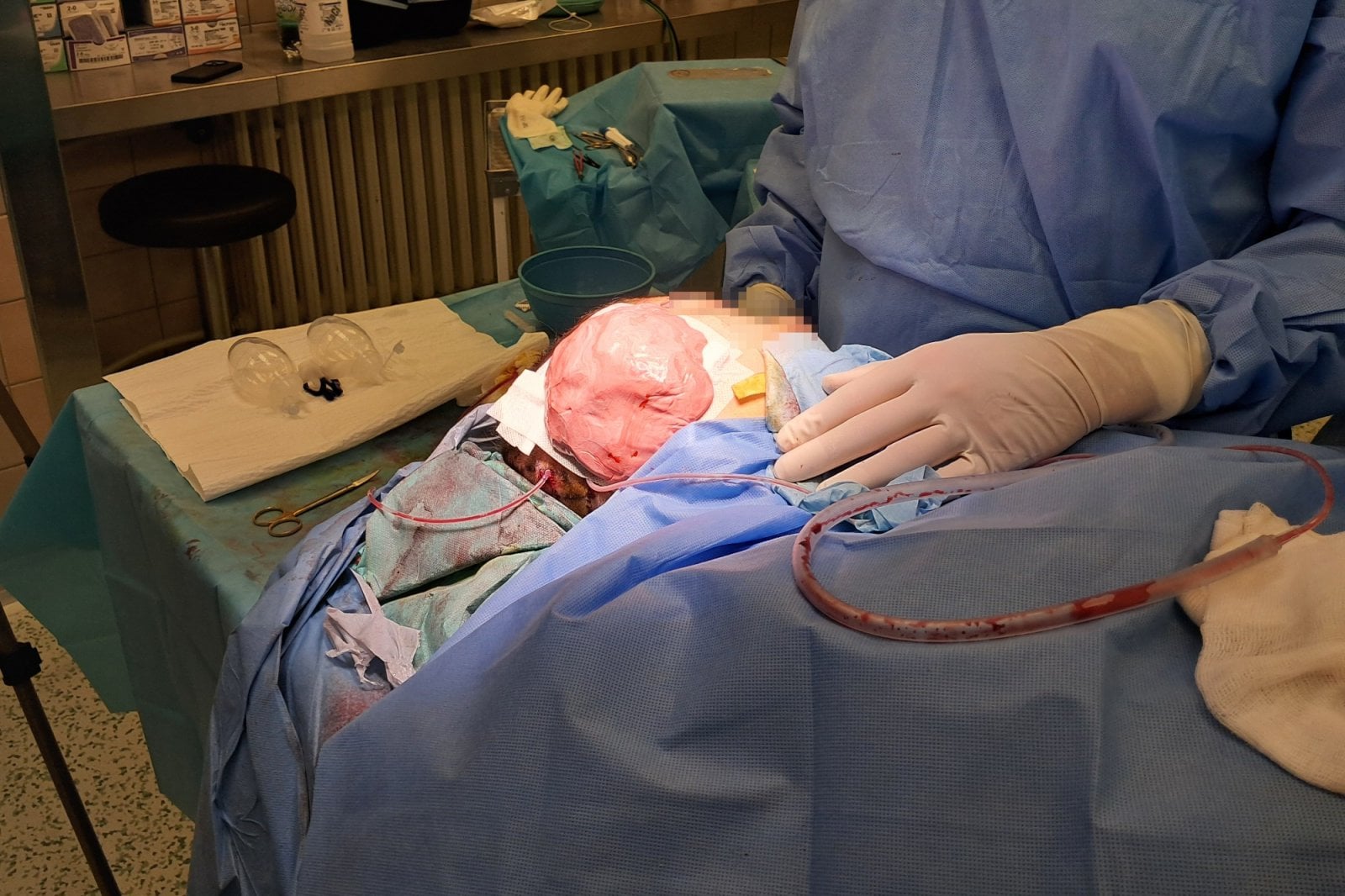 Nová metoda léčby dětí s mikrocií