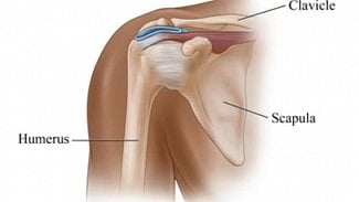 Náhledový obrázek - Lékaři v Brně voperovali mladíkovi umělou lopatku včetně kloubu