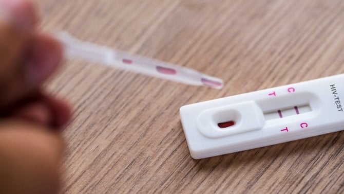 Detail rychlého testu na HIV z kapky krve