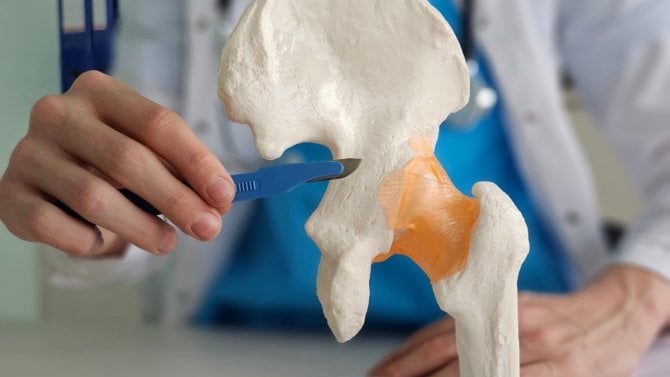 Kyčel, kyčelní kloub