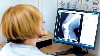 Náhledový obrázek - Radiologové: Komentář k poklesu úhrad pro radiodiagnostiku v roce 2013